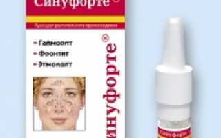 Синуфорте