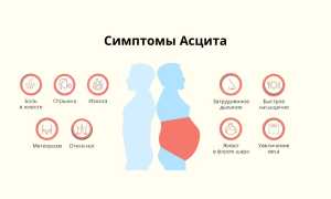 Асцит при гепатите С