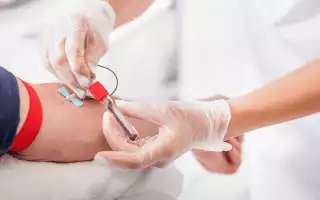 Положительный анализ на гепатит С антител Anti-HCV-total