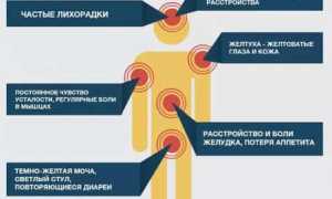 Гепатит С у женщин: симптомы, признаки, лечение