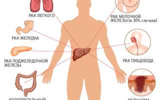 Почему рак чаще всего метастазирует в печень?