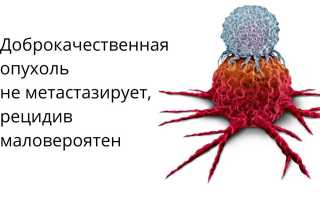 Доброкачественная и злокачественная опухоли