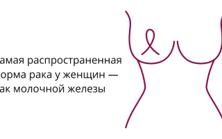 Виды рака: классификация онкологических заболеваний