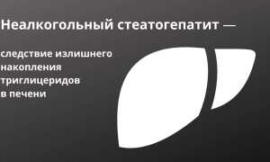 Неалкогольный стеатогепатит: что за болезнь?