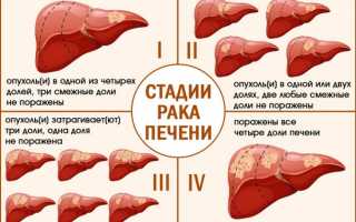 10 симптомов, которые могут указать на рак печени