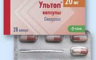 Ультоп