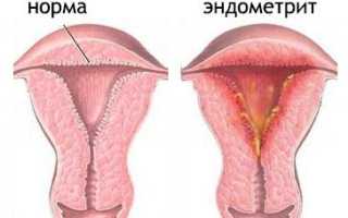 Почему после месячных появляются коричневые выделения
