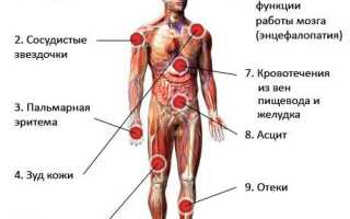 Гепатит B — симптомы и лечение