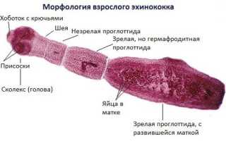 Эхинококкоз, что это такое? Причины и лечение у человека