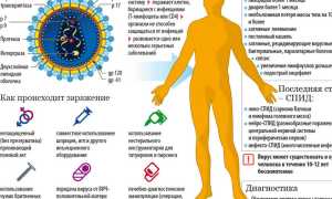 Найден способ заставить иммунную систему бороться с ВИЧ
