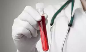 Диагностика вирусных гепатитов