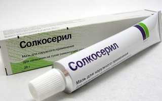 Солкосерил