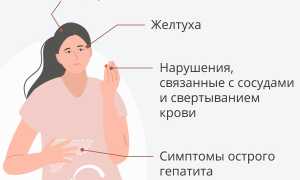 Боль в животе может означать проблемы с печенью