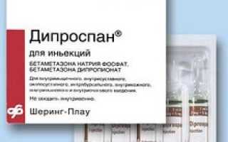 Дипроспан уколы: инструкция по применению