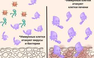 Аутоиммунный гепатит