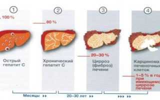 Гепатит С 3 стадия – что это такое?