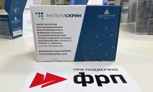 В РФ открылось производство комбинированных тестов на ВИЧ