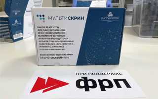 В РФ открылось производство комбинированных тестов на ВИЧ