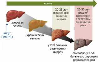 Гепатит Б — основной источник рака печени во всём мире