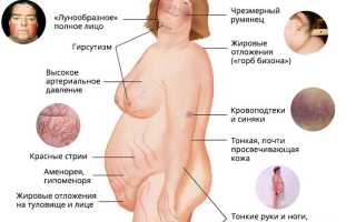 Синдром Иценко-Кушинга