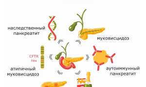 Хронический панкреатит: как его лечить?