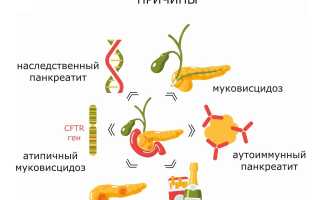 Хронический панкреатит: как его лечить?