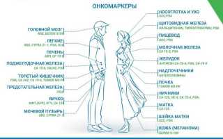 Что такое онкомаркеры?
