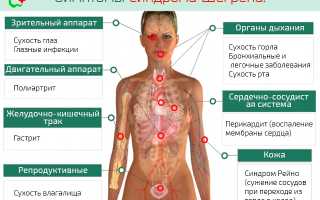 Синдром Шегрена – что это такое и как лечить?