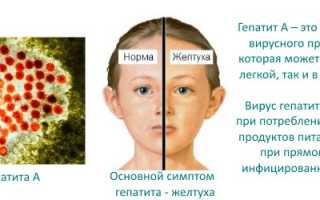 Заразившихся гепатитом С онкобольных детей превышает сотню