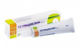 Можно ли лечить прыщи тетрациклиновой мазью