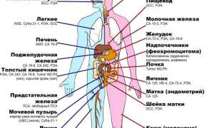 Онкомаркеры: что это и для чего нужно?
