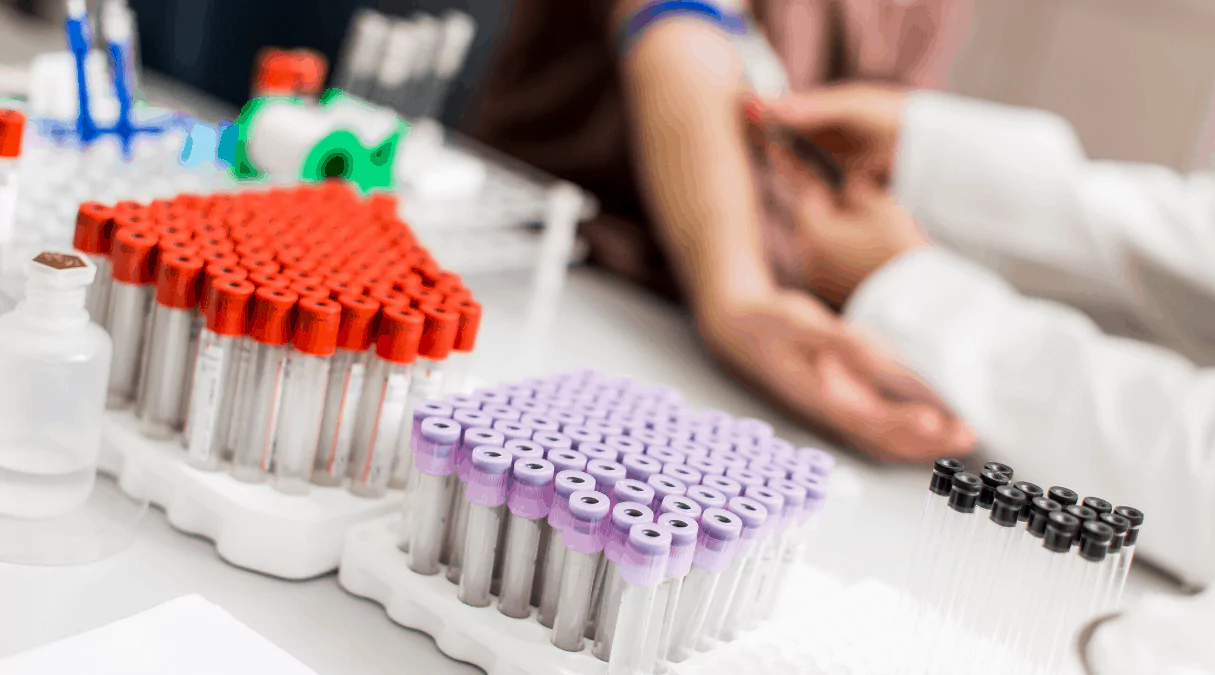 Где сдавать анализы на антитела к HCV