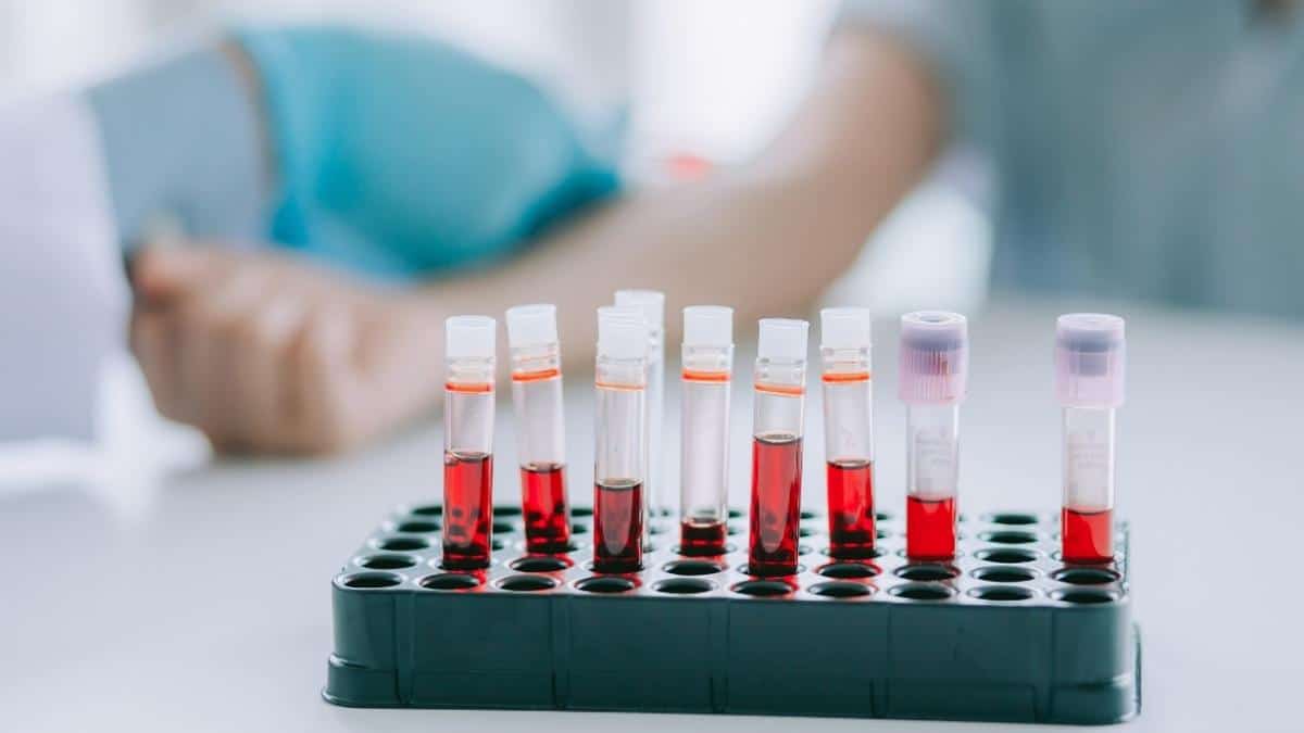 Выявить гепатит С: инкубационный период заболевания