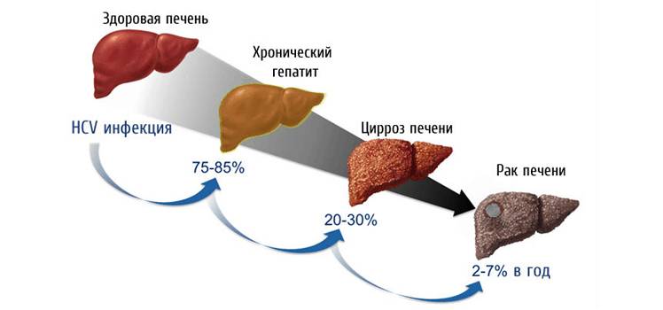 Что покажет Фиброскан