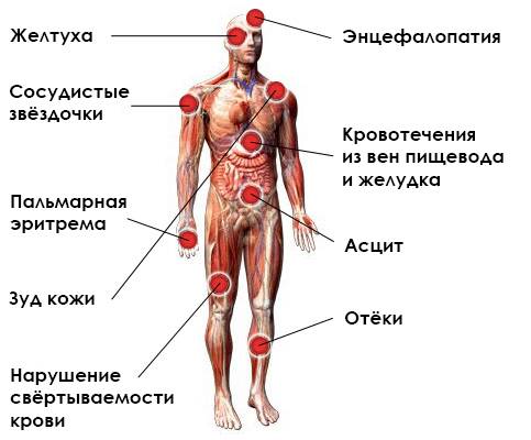 Проявления гепатита С у мужчин
