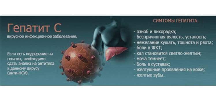 Симптомы гепатита С у мужчин
