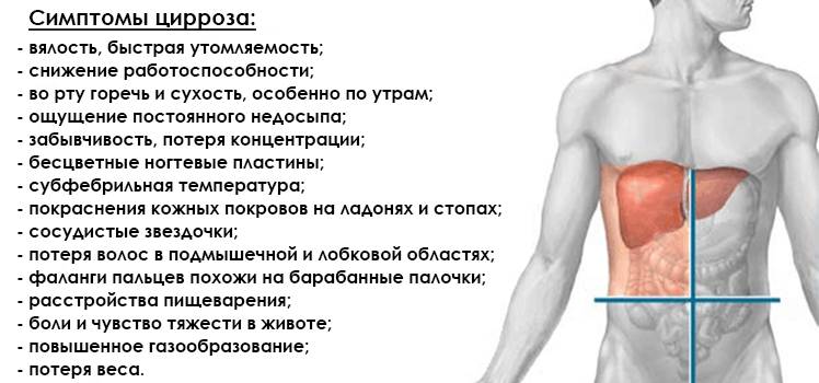 Симптомы цирроза