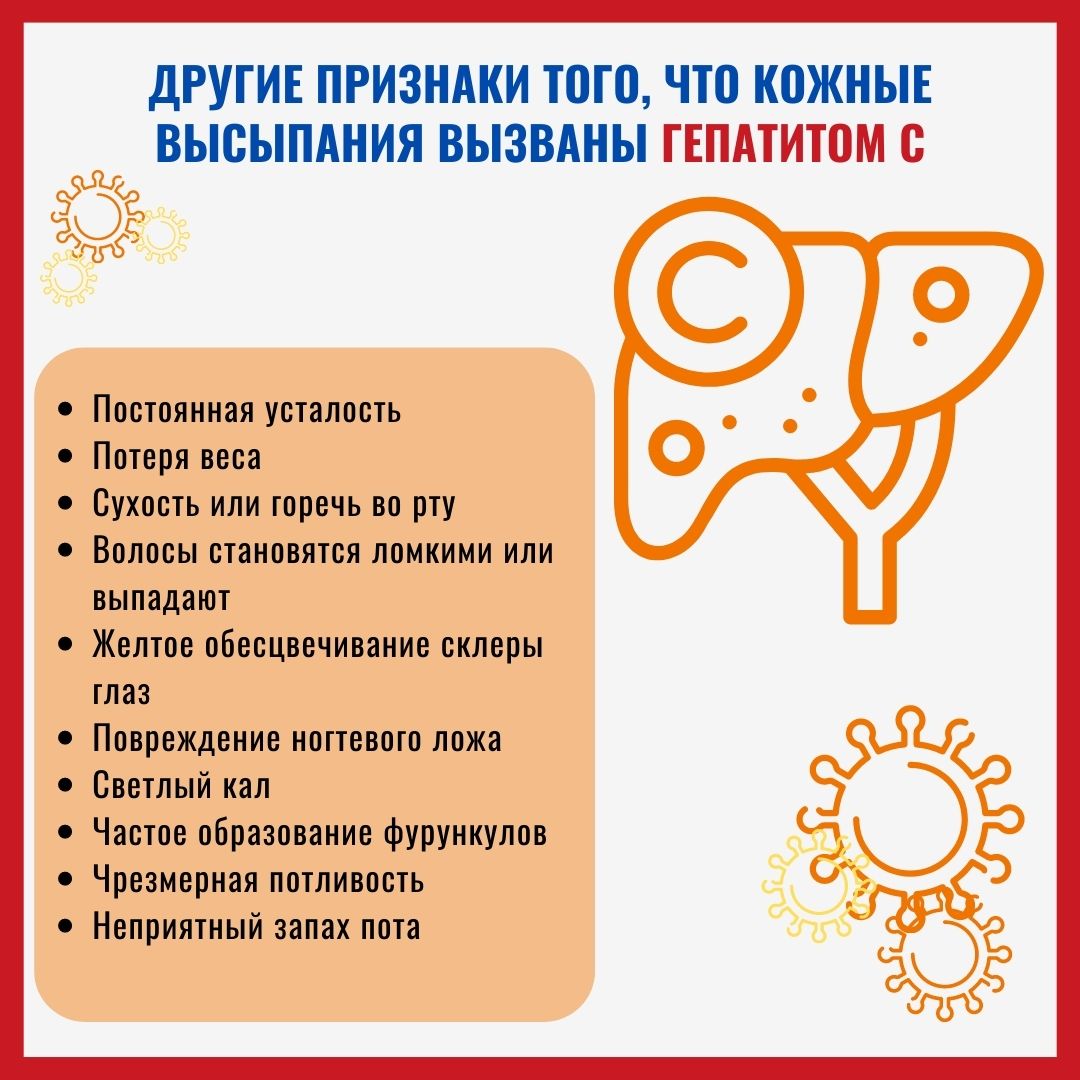 Сыпь при гепатите С