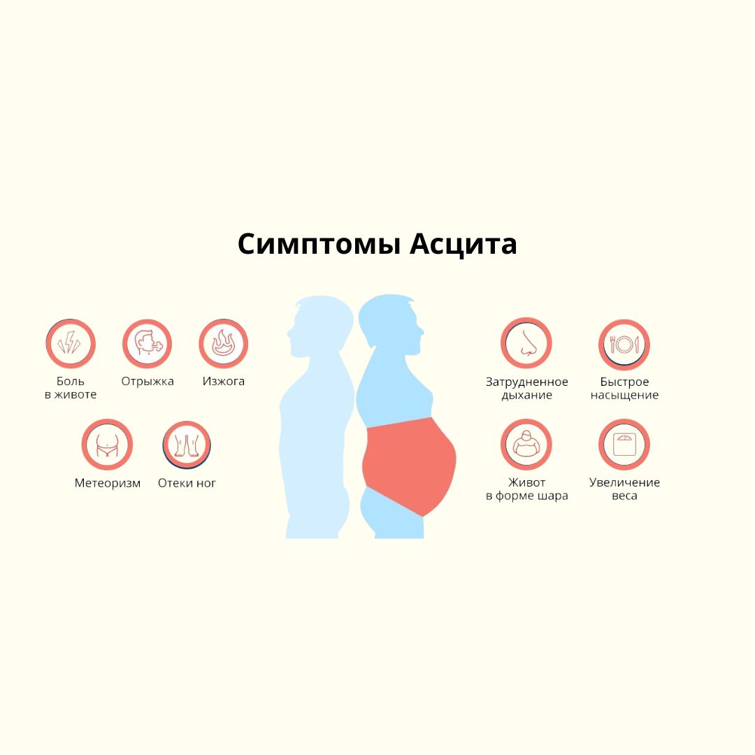 Асцит при гепатите С