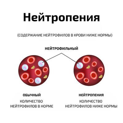 Нейтропения у больных хроническим гепатитом С